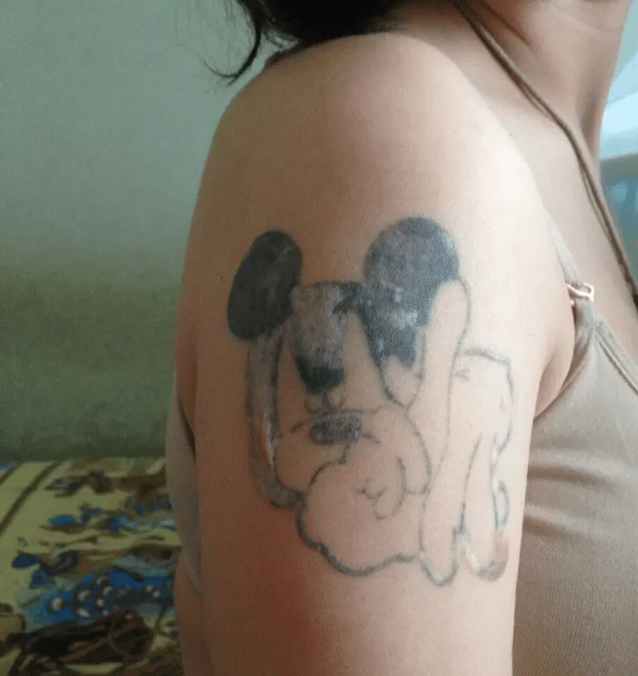 How to remove a tattoo at home? The truth about DIY methods — What do you get after this kind of “home tattoo removal”?