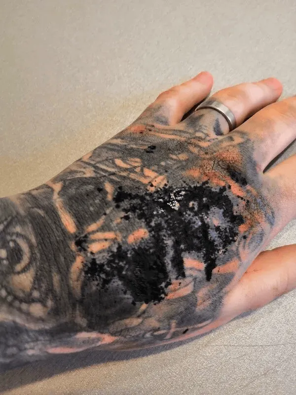 How to remove a tattoo at home? The truth about DIY methods — Potassium permanganate for tattoo removal: why it’s dangerous