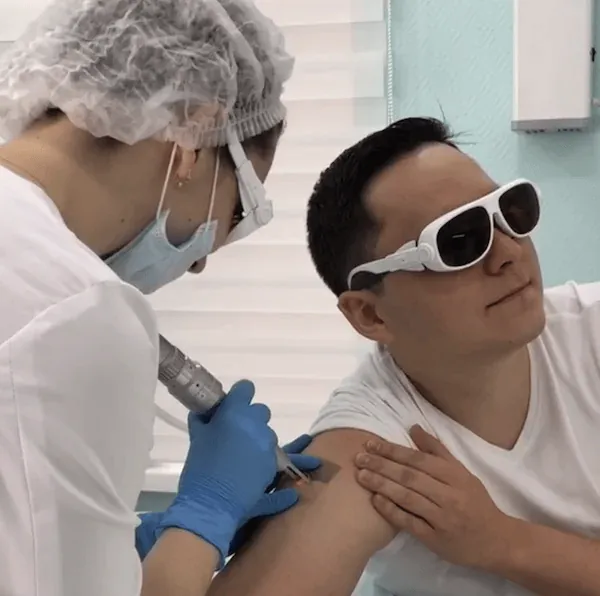 Hapus tato laser pada diri sendiri: eksperimen pribadi saya — Sesi hapus tato laser pertama