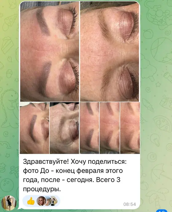 Отзыв ученицы с фото до и после удаления