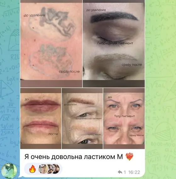 Отзыв с фото работ до и после