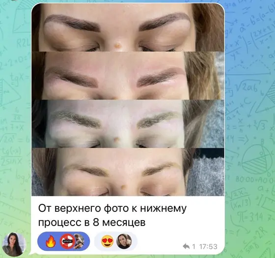 Процесс удаления бровей за 8 месяцев