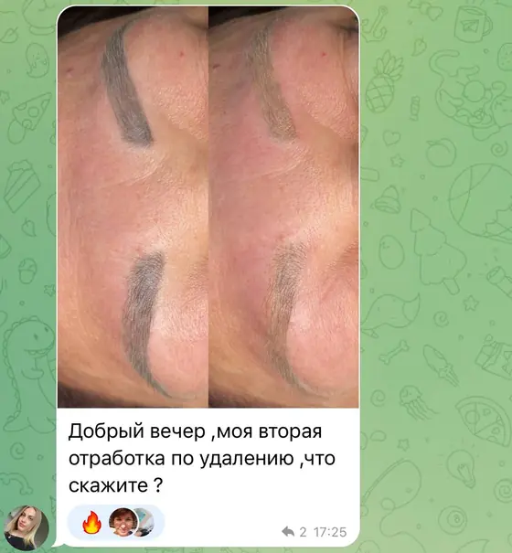 Вторая отработка по удалению