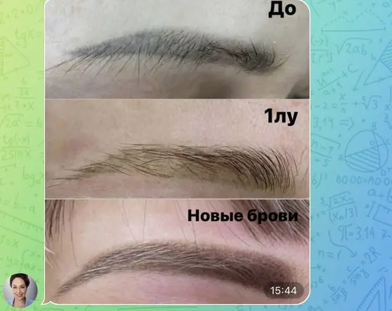 Брови до удаления, после первого сеанса и новые брови