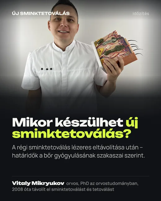 Borító: Mikor készülhet új sminktetoválás a lézeres eltávolítás után
