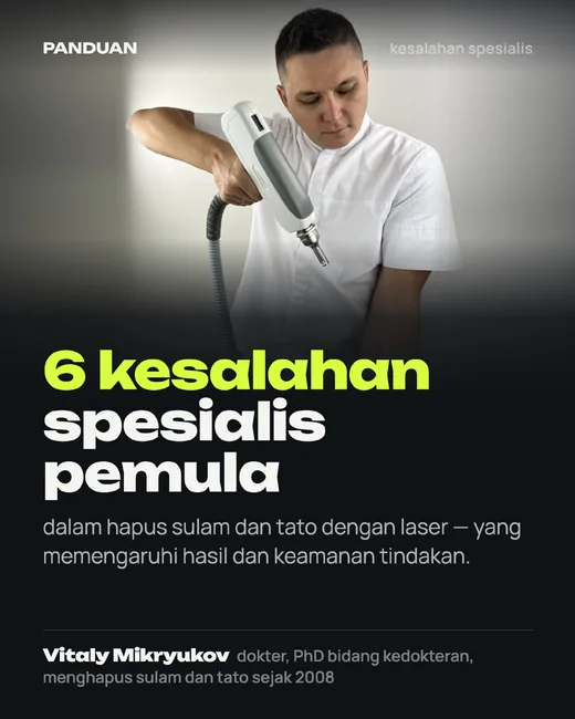 Sampul: 6 kesalahan spesialis pemula dalam hapus tato dengan laser