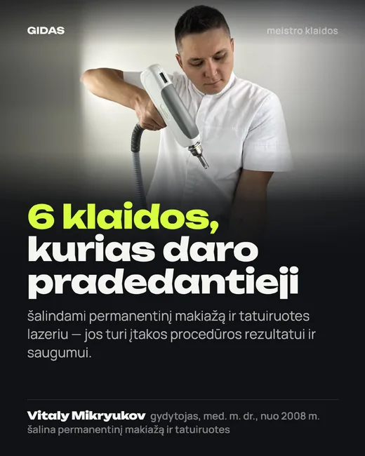 Viršelis: 6 pradedančiojo meistro klaidos šalinant lazeriu