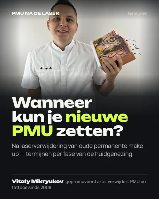 Omslag: Wanneer kun je nieuwe PMU zetten na laserverwijdering?