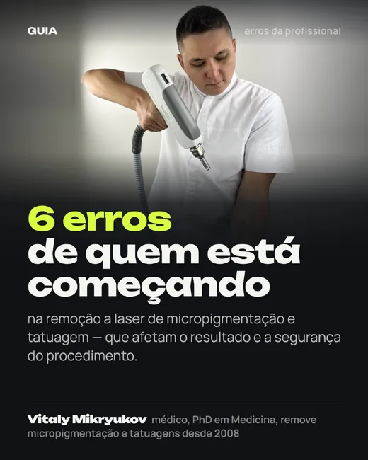 Capa: 6 erros de quem está começando na remoção a laser