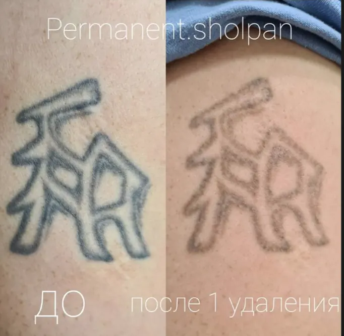 Кейс: Шолпан