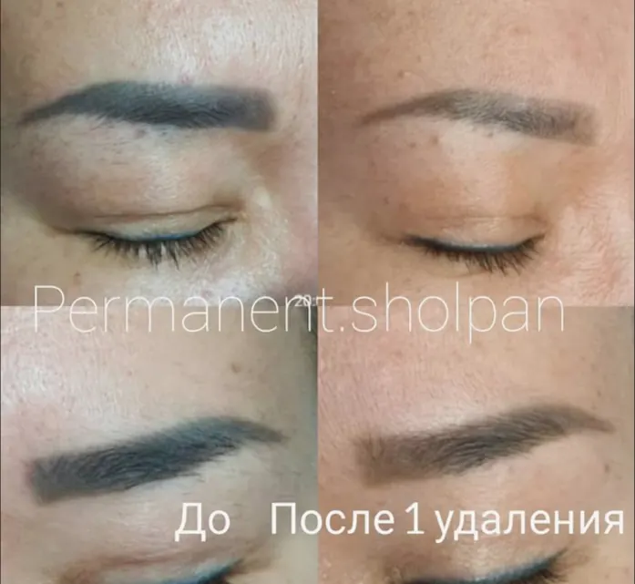 Кейс: Шолпан