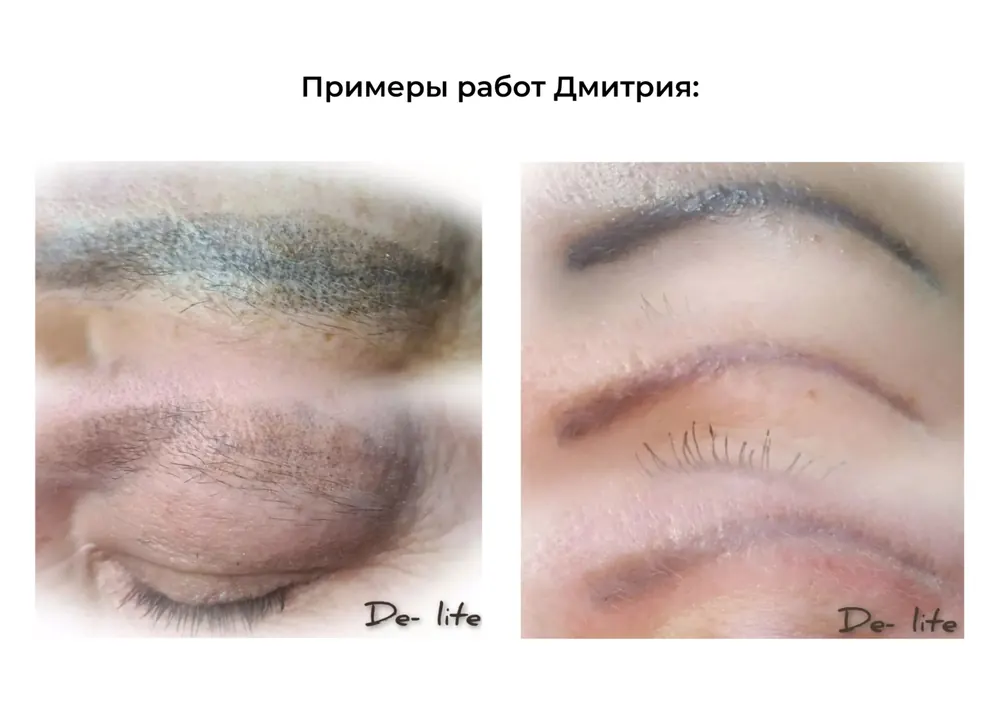 Кейс: Дмитрий Докашенко