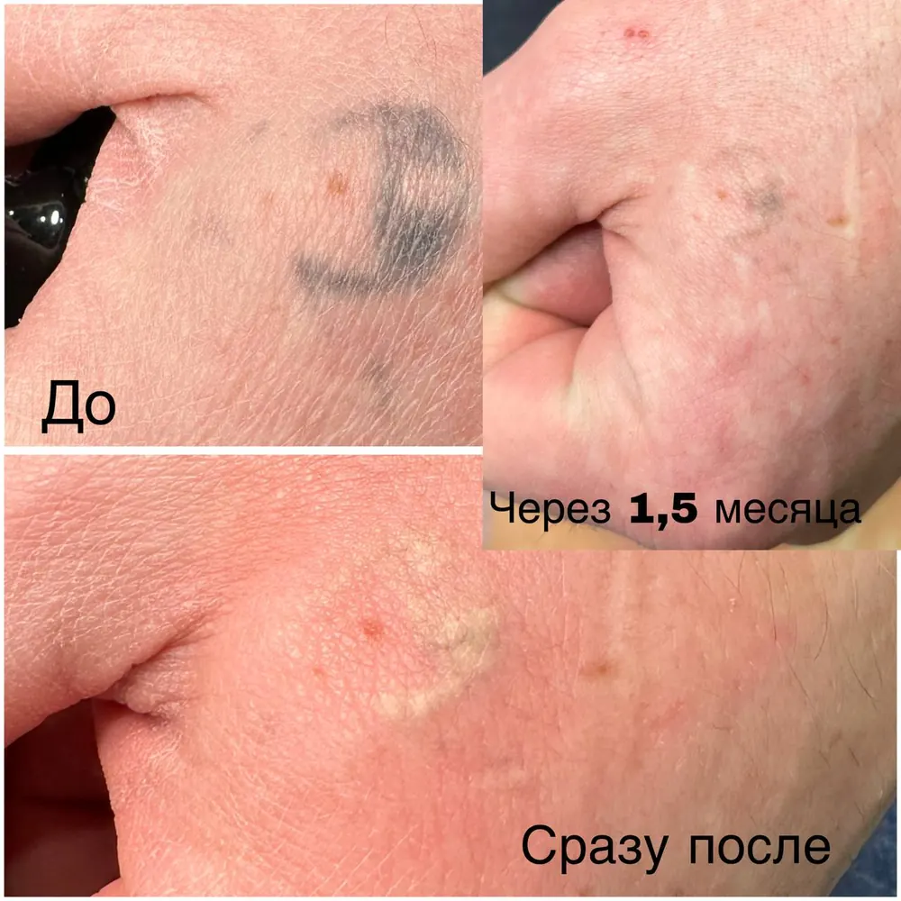 Кейс: Тамара Палу