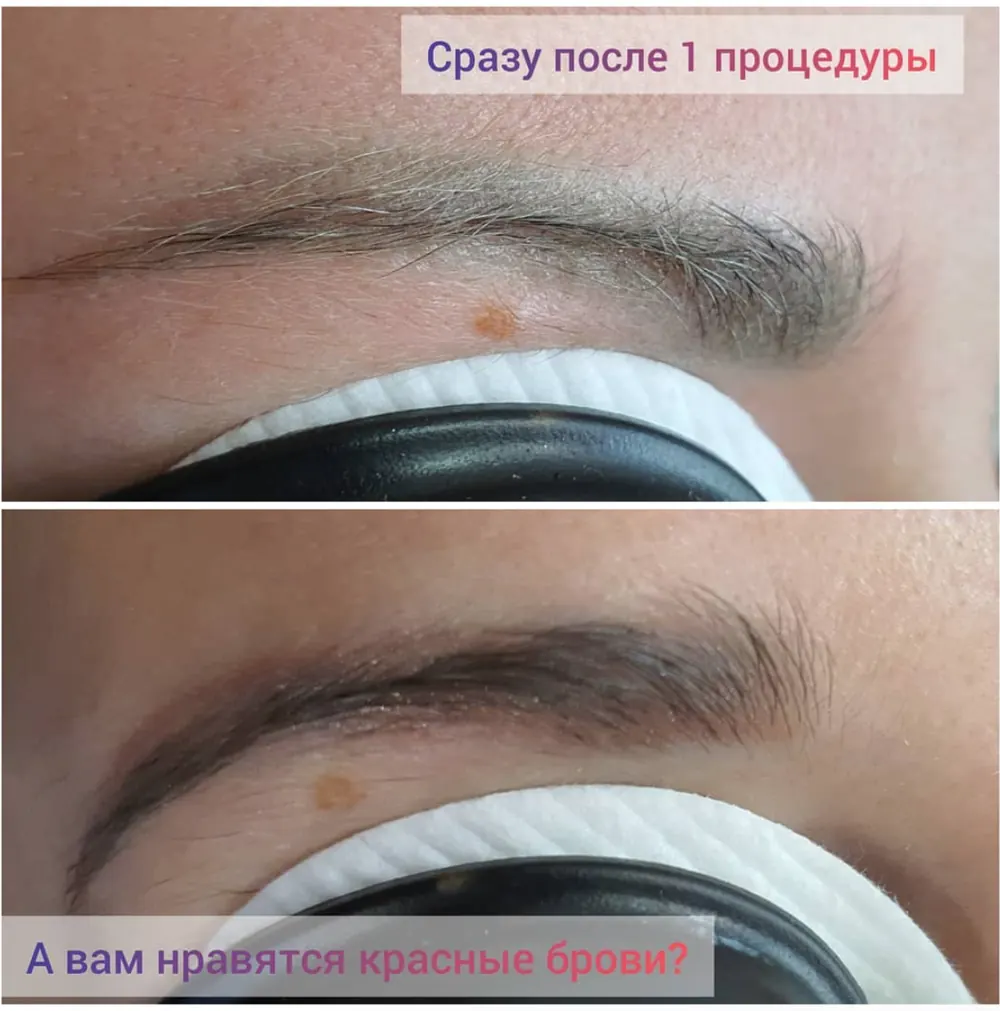 Кейс: Чуб Александр