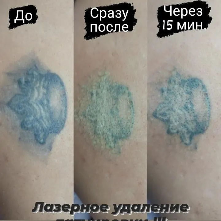 Кейс: Ворощук Роман