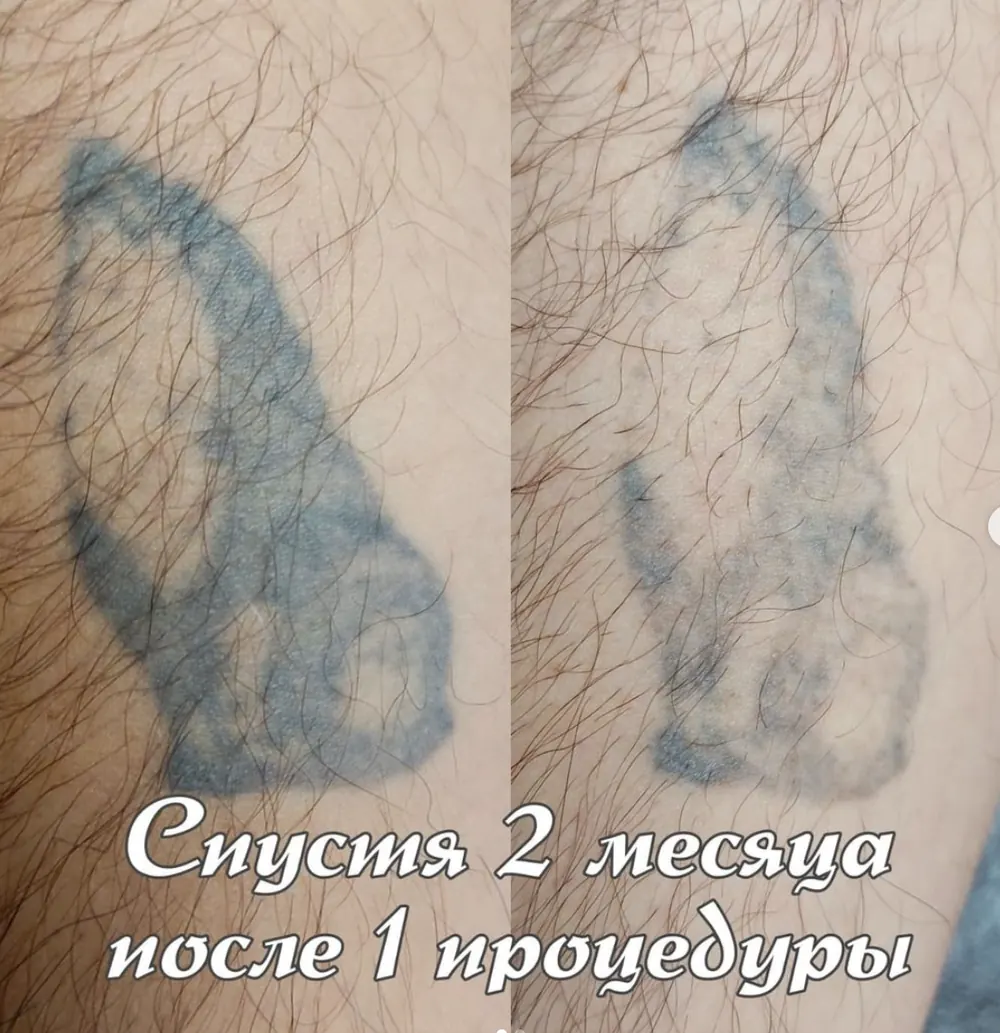 Кейс: Ворощук Роман