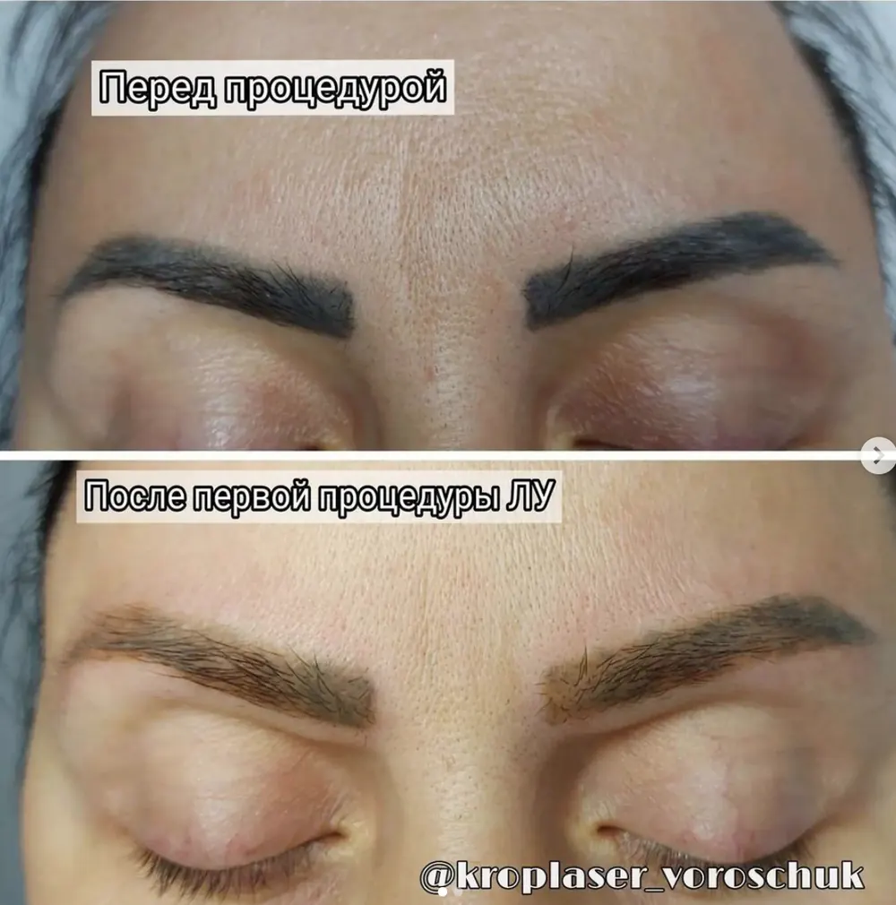 Кейс: Ворощук Роман