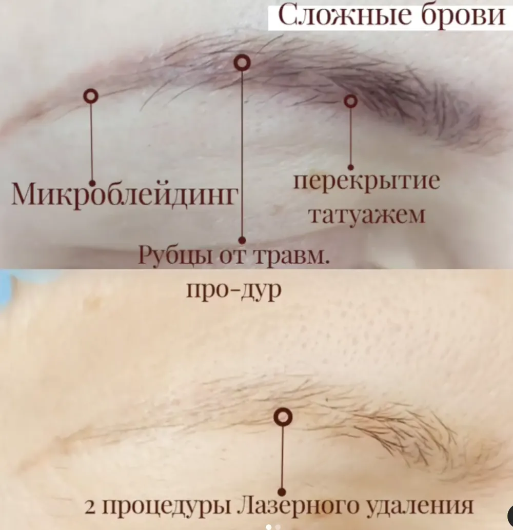 Кейс: Ворощук Роман