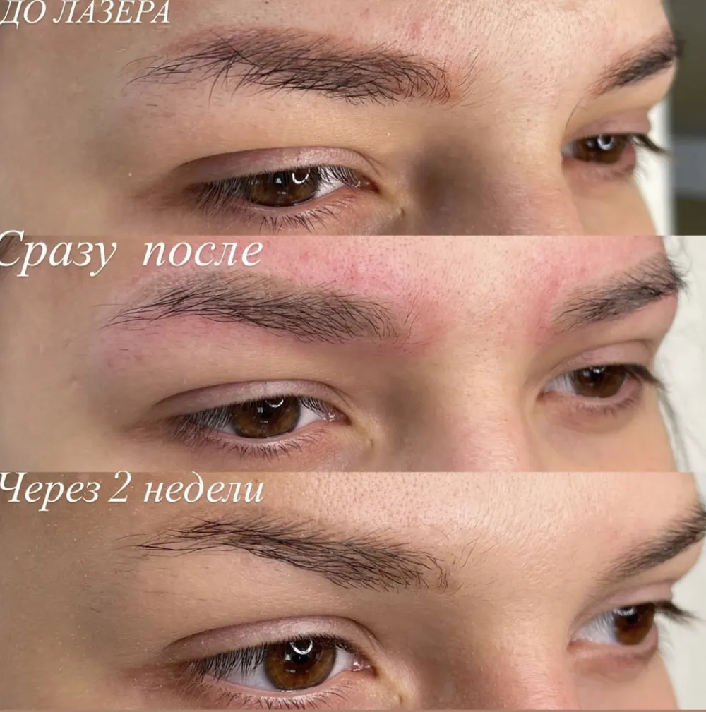 Кейс: Герусова Надежда